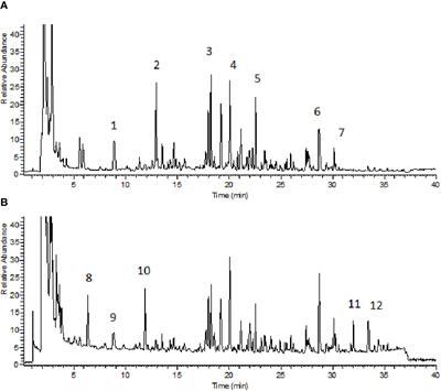 Buzhongyiqi Decoction Protects Against Loperamide-Induced Constipation by Regulating the Arachidonic Acid Pathway in Rats